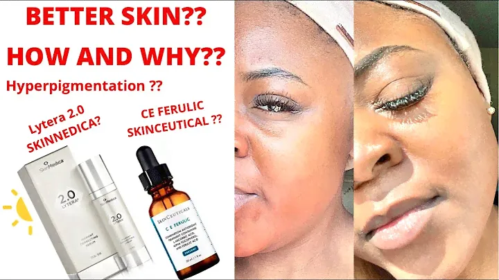 Why and How CE Ferulic from Skincuetical is giving me Better Skin