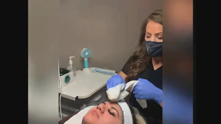 Microdermabrasion and Skin Ceuticals Gel Peel
