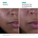 Силимарин CF сыворотка, 30 мл. - Skinceuticals