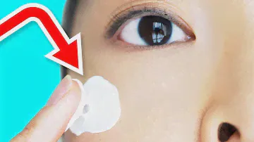 HOW TO: Get Rid Of Dark Spots On Your Face!