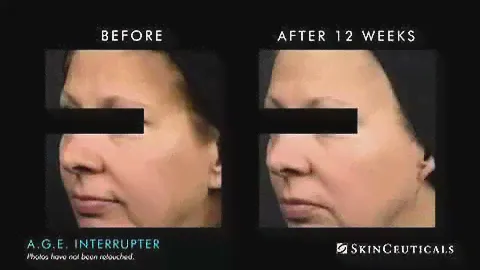 SkinCeuticals A G E  Interrupter at Fine Lines MedSpa Tampa