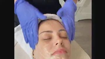 SkinCeuticals Gel Chemical Peel GL