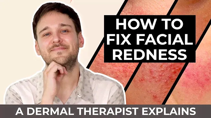 Treating Redness: Skincare For Redness | Professional Treatments For Redness
