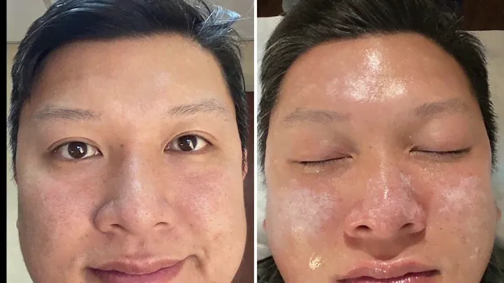 Introducing NEW SkinCeuticals Smart TCA Peel