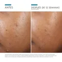 Phyto A+ Brightening Treatment, 30 ml. - Skinceuticals