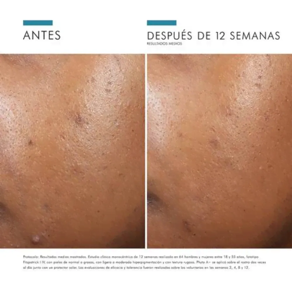 Phyto A+ Brightening Treatment, 30 ml. - Skinceuticals-4
